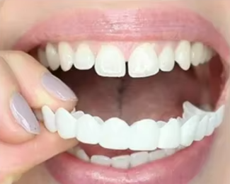 Facetas Dentarias Removíveis -PerfectSmile