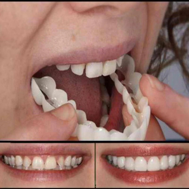 Facetas Dentarias Removíveis -PerfectSmile